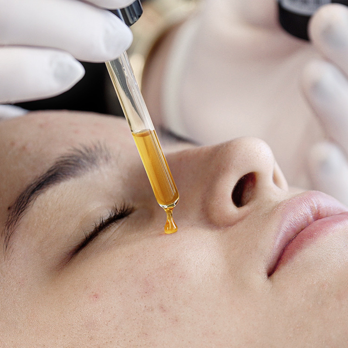 BLACK SECRET PEELING ANTIACNE 30 ML