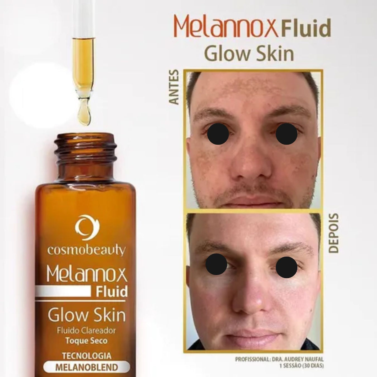 Sérum Clareador e Iluminador Melannox Glow Skin Cosmobeauty