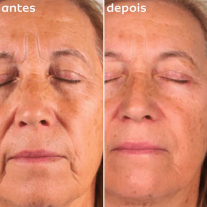 Clareador Facial Anti Envelhecimento Mellanderm Cosmobeauty