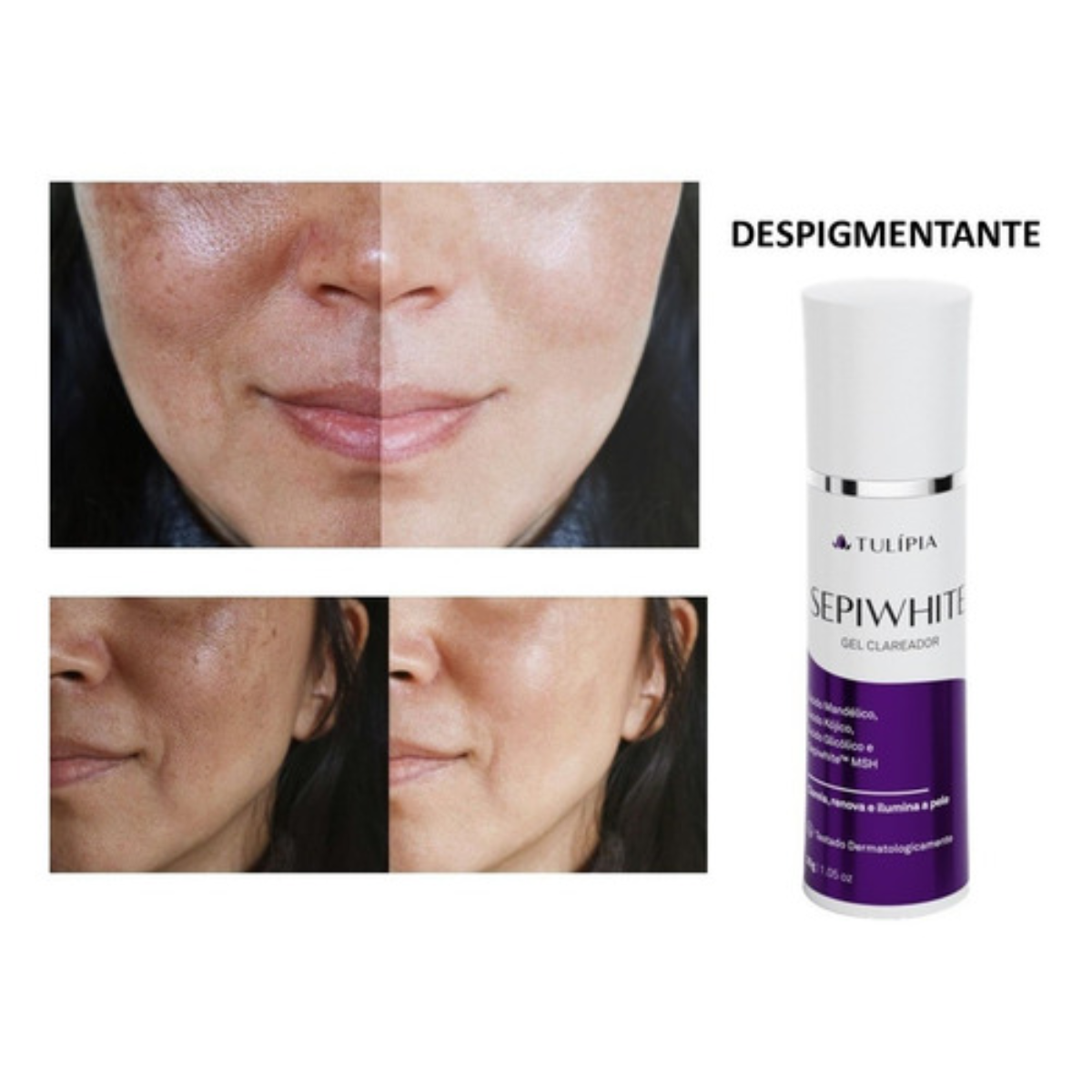 Kit Serum Clareador De Melasma Manchas Em Geral Anti-rebote