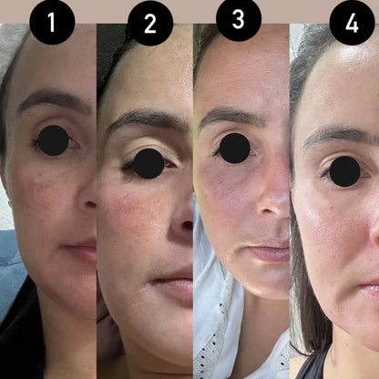 Sérum Clareador e Iluminador Melannox Glow Skin Cosmobeauty