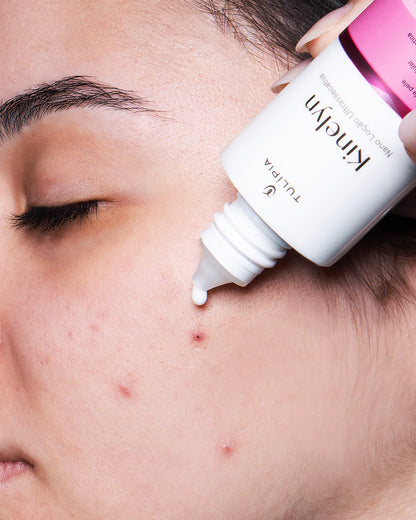 Kit Tratamento Antiacne Oleosidade Tulipia Completo 5 Itens