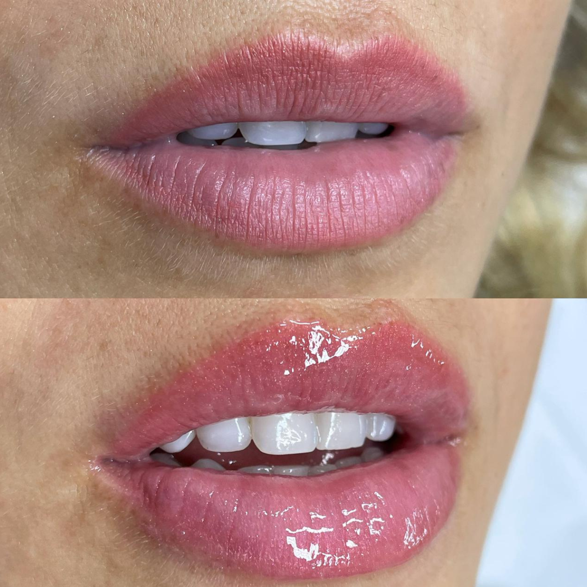 Kit Facial e Labial Tulípia Sabonete Mousse Esfoliante Gloss
