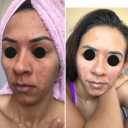 Sérum Clareador e Iluminador Melannox Glow Skin Cosmobeauty