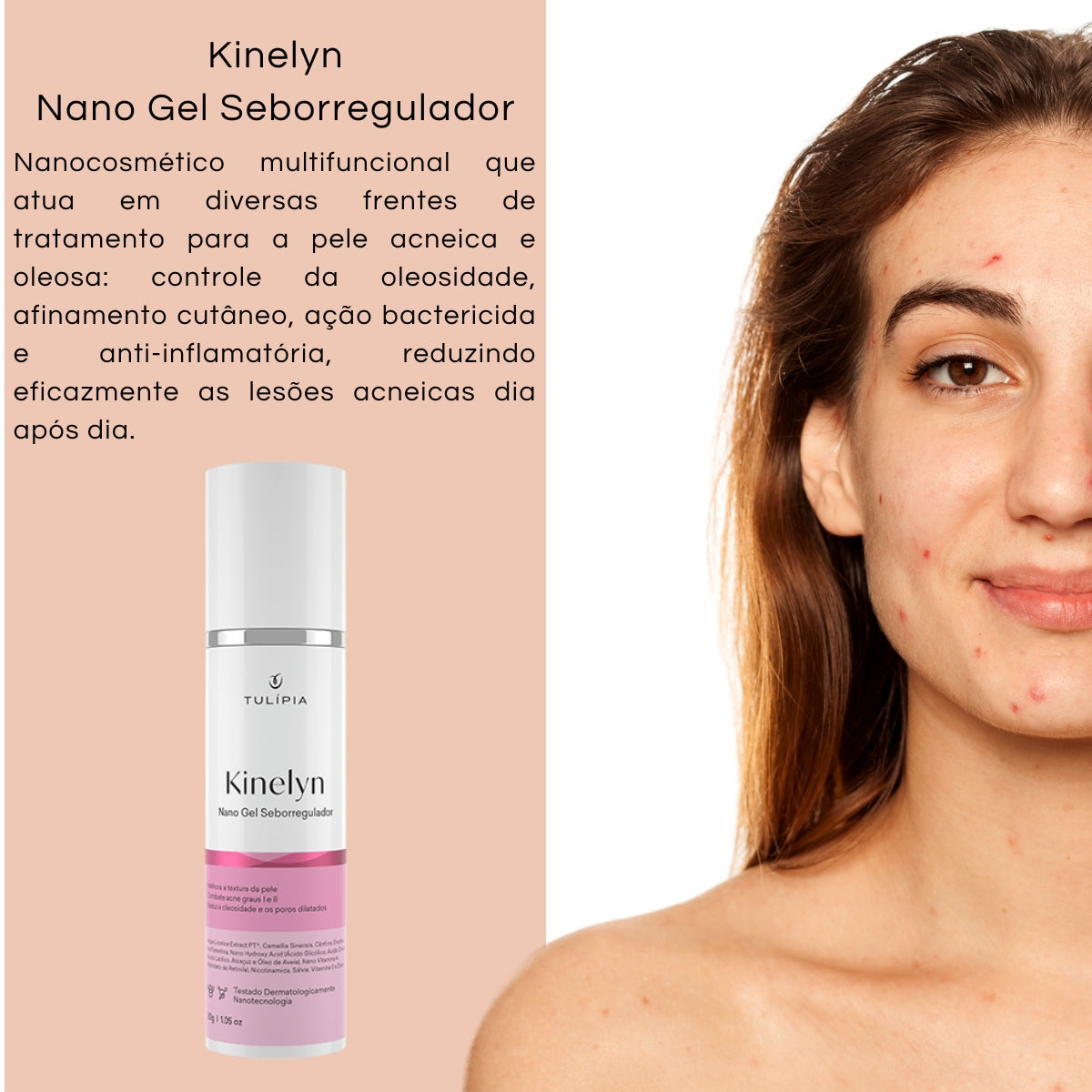 Kit Facial Kinelyn Pele Acneica e Oleosa Seborregulador