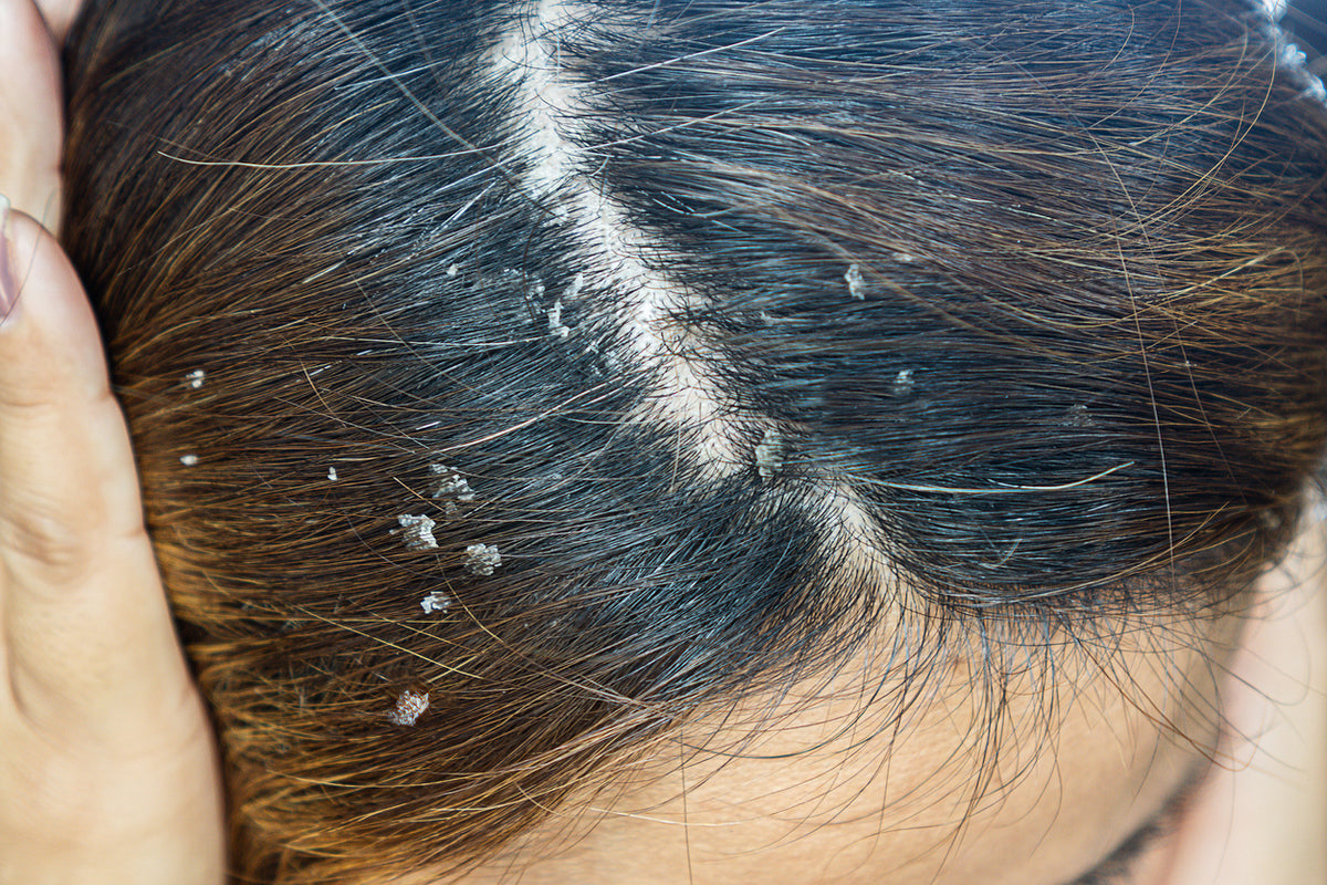 Shampoo Anticaspa Oleosidade Coceira Crescimento Smart GR