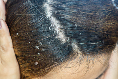 Shampoo Anticaspa Oleosidade Coceira Crescimento Smart GR