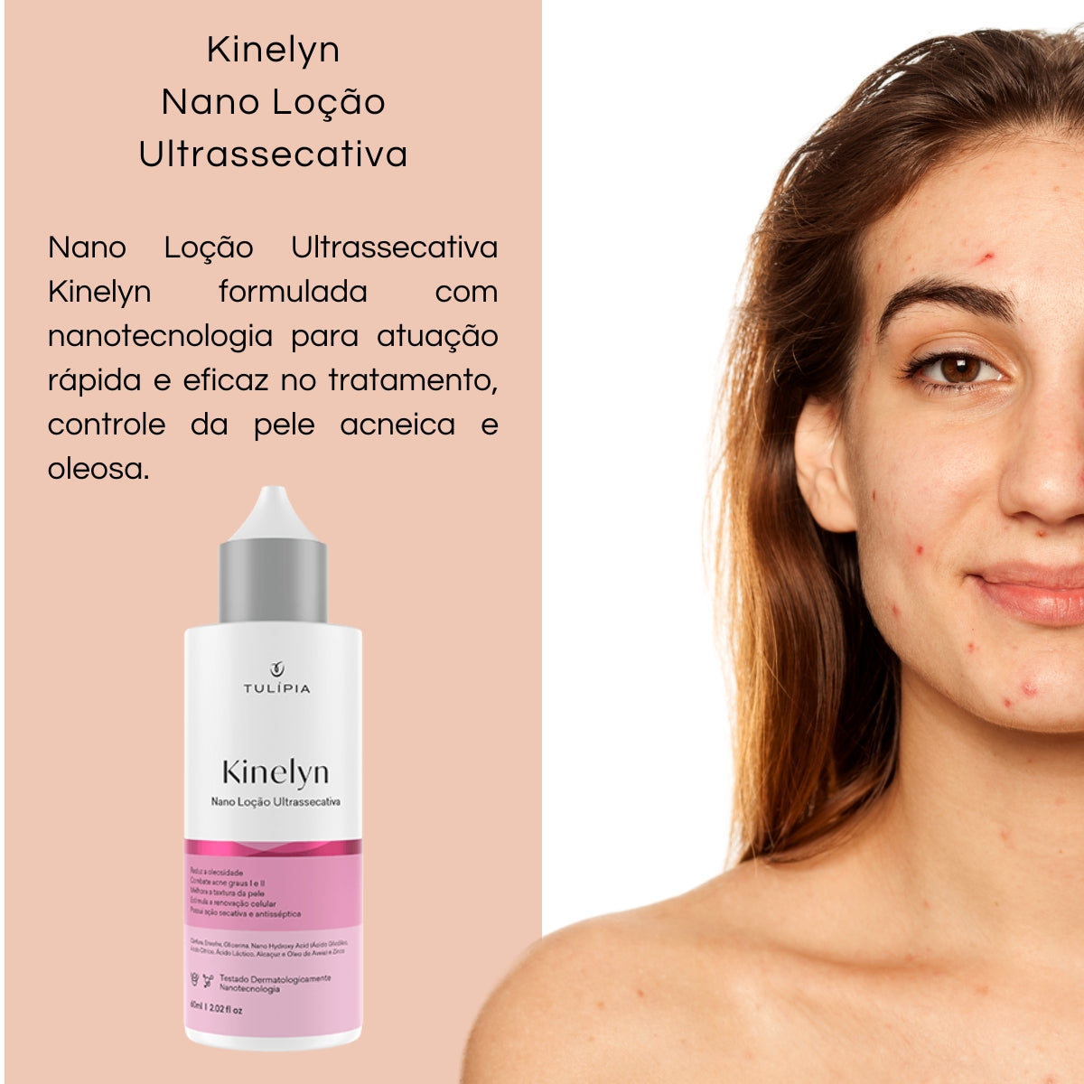 Kit Facial Kinelyn Pele Acneica e Oleosa Seborregulador
